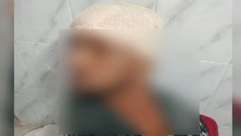 মাধবপুরে বন প্রহরীকে কু*পি*য়ে জখম