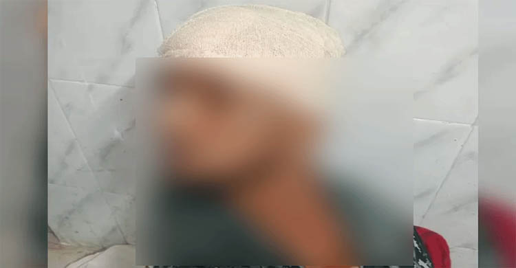 মাধবপুরে বন প্রহরীকে কু*পি*য়ে জখম